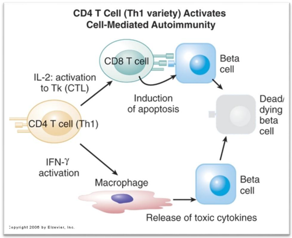  فعال شدن واکنش خود ایمنی با واسطه سلولی، توسط سلول های لنفاوی کمکی(T helper 1) که منجر به مرگ سلول های بتای پانکراس می شود