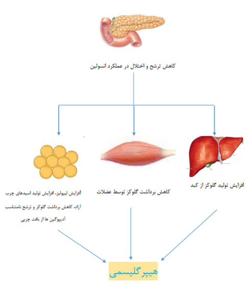 پاتو فیزیولوزی هیپر گلیسمی و افزایش اسیدهای چرب در گردش خون در دیابت نوع 2